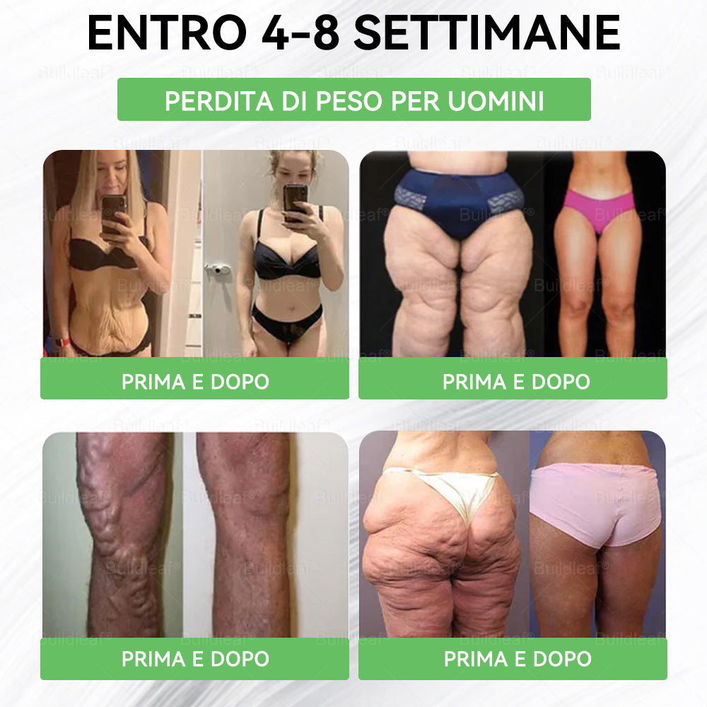 🎄💖Negozio ufficiale | BuildLeaf® GLP-1 8-in-1 Fit & Vital Soluzione Orale (Solo una volta al giorno, cambiamenti visibili in 7 giorni) ✅ Per obesità, salute cardiovascolare, diabete, apnea notturna, salute intestinale, problemi articolari e altro